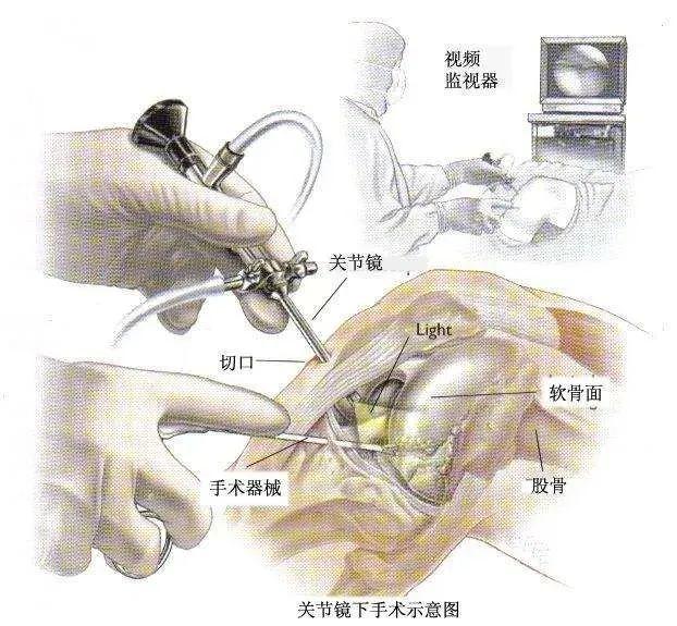 发朋友圈晒步数的幽默说说搞笑句子，发朋友圈晒步数的幽默说说搞笑短句？