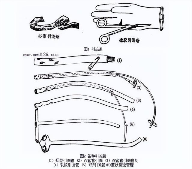 引流是什么病，肚子插管引流是什么病？